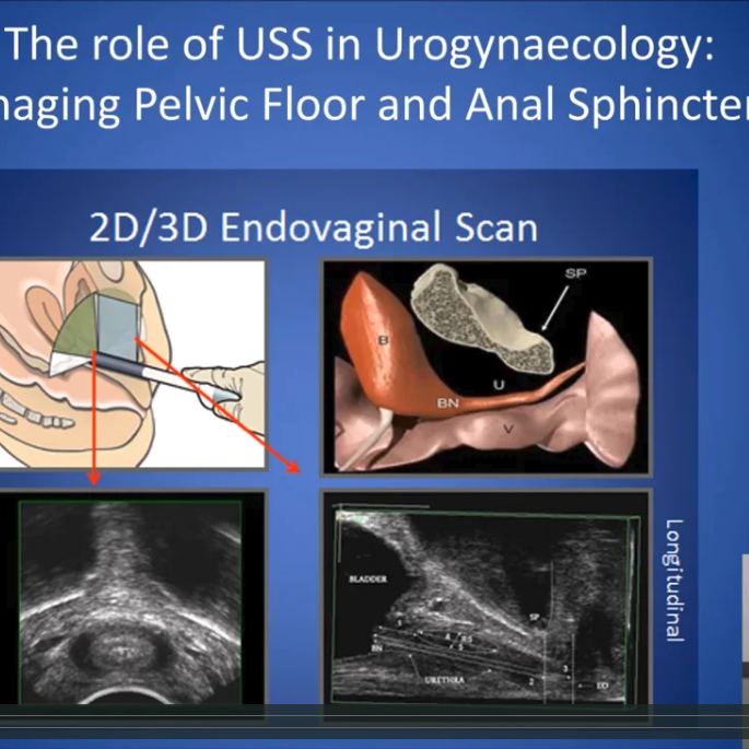 The Role of USS in Urogynaecology Imaging Pelvic Floor and Anal Sphincter
